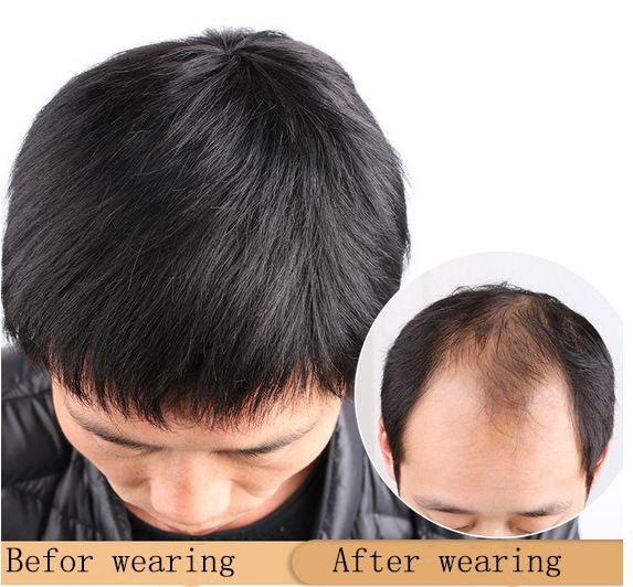 Hand-woven wig Men's hair patches True hair patches Searless cover White pile inches Short Mediterranean bald hair patch