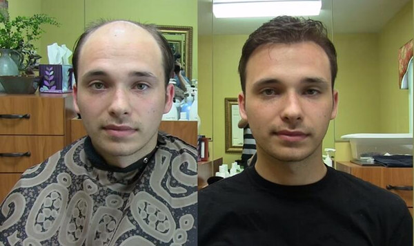 wholesale -Men toupee mono with skin man hair replacement No-surgical hair system agaist hair loss