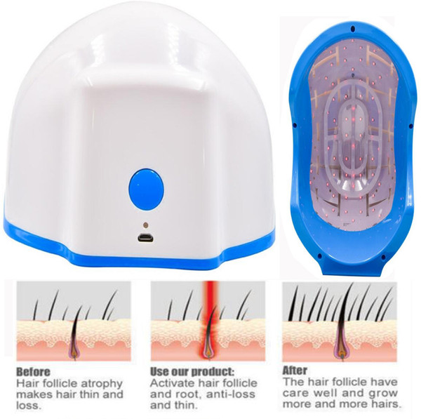 New hair scale treatment for hair loss treatment 80 medical diode laser hair regrowth cap helmet