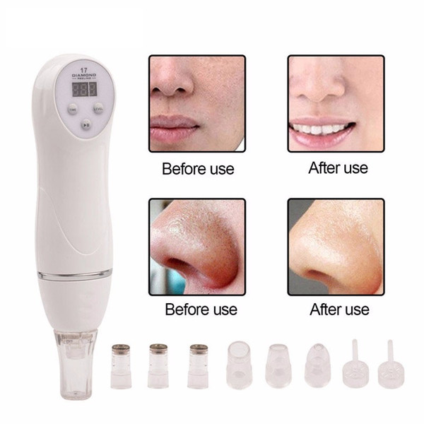 Tm-Md004 Moq 1 Diamond Blackhead Vacuum Suction Remove Scars Acne Marks Face Beauty Device Dermabrasion Microdermabrasion Home Use