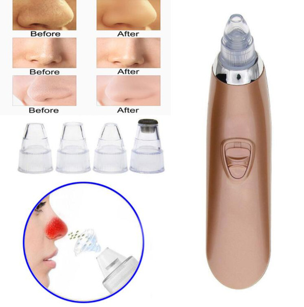 Vacuum Pore Cleaner Blackhead Remover Suction Machine Comedo Microdermabrasion Face Pore Cleaning ABS PP Free Shipping