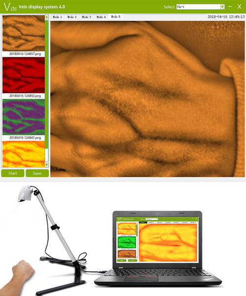 Infrared Vein Finder Viewer -HD display vein imaging light,Vein Illumination Detector, On Various Skin