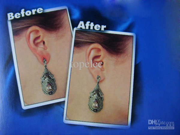 Factory Price Ear Lift Medical Ear Support 1set=60pcs from DHgate authorized member #1138