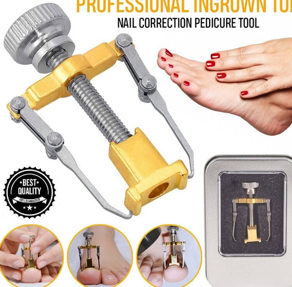 2018 Smart Ingrown Nails Corrector Device Professional Toenails tools Practical Pedicure Foot Bunion Protector free shipping