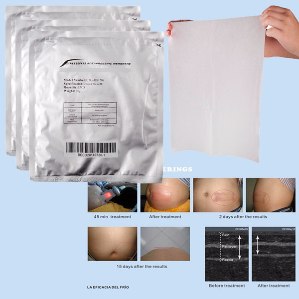 Antifreeze Membrane 27*30CM 34*42CM Antifreezing membrane For Weight Loss Anti-freezing Membrane pad for cryo therapy KKA2000