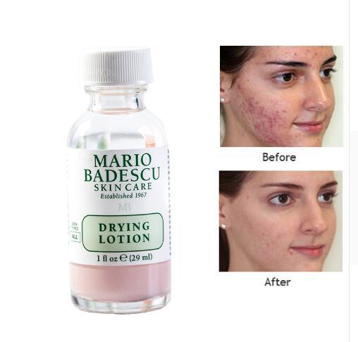 VIBRANT GLAMOUR An effective Acne Treatment Mario Badescu Drying Lotion 29ml Anti