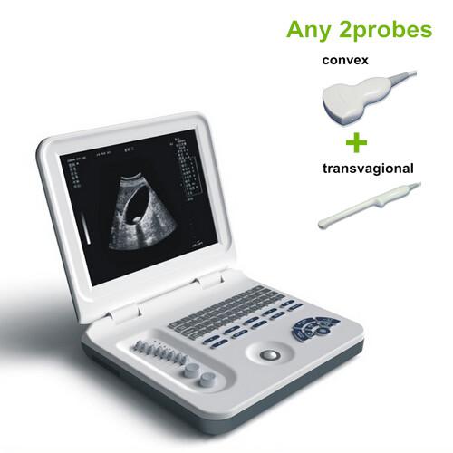 ultrasound scanner with stardard li-battery, notebook ultrasound machine led screen, free shipping by DHL, Fedex, TNT.