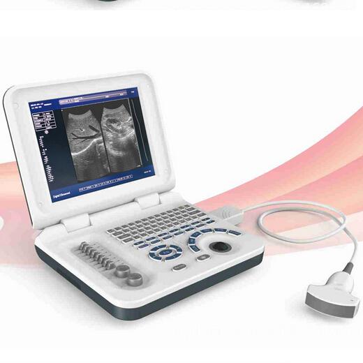 12inch lcd Screen Digital Notebook B Type Ultrasound Diagnostic Echo Ultrasound Scanner Machine Convex Array Probe And Internal Battery