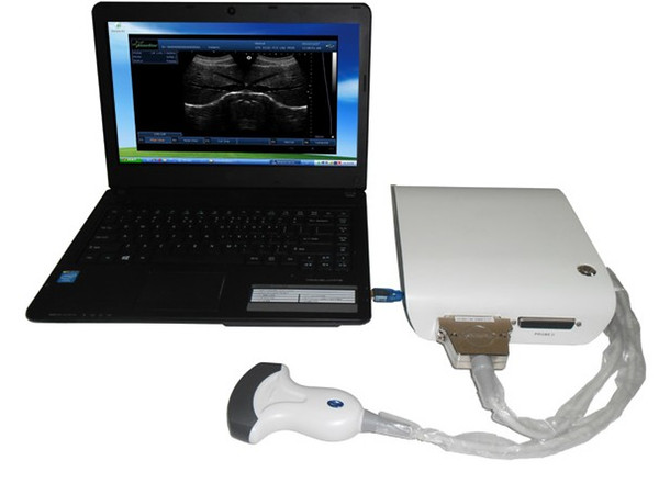 CE&ISO Ultrasound Scanner Box with small size and powerful function/ultrasonic Box machine/Stable VET or human echo box device/PC Sonography