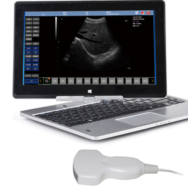 Free Ship Advanced USB convex probe with ultrasound scanner software and advanced quality/Echo machine/small probe ultrasound/CE sonography