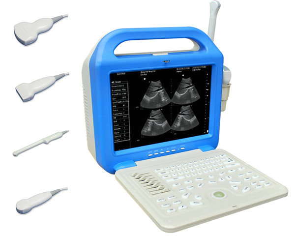 Laptop USG ultrasonic machine/CE echo machine/stable sonography/High quality and factory price Laptop Ultrasound Scanner+12inch LCD screen