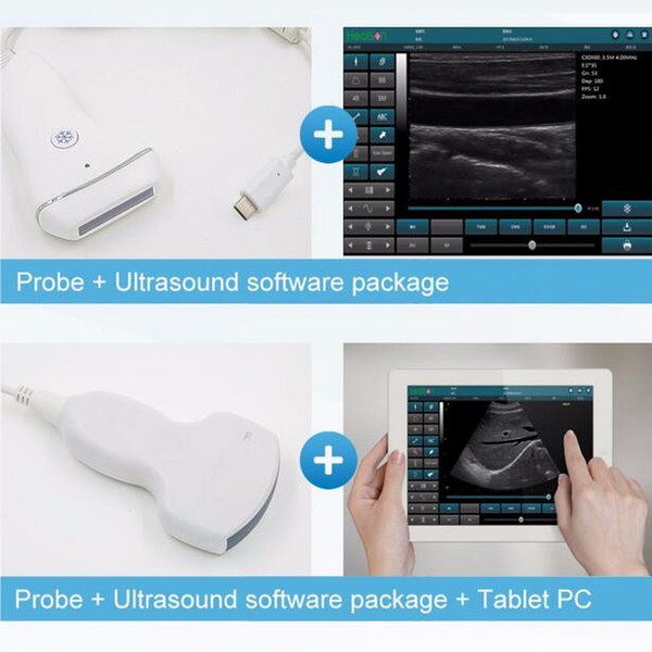 Free shipping cheap price USB convex/linear probe+ultrasound software, ultrasound scanner, cheap price ultrasound machine, B ultrasound