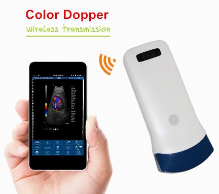 3.5-5.0Mhz128elements Wireless Ultrasound Scanner convex Probe with color IOS/andriod system,wireless ultrasound,ultrasound scanner