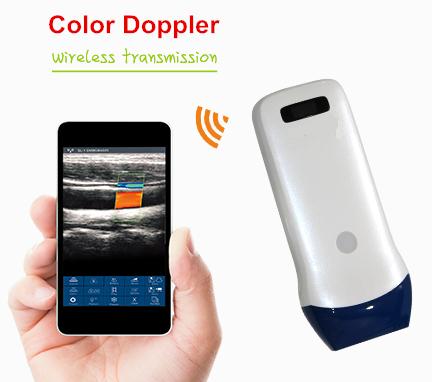 7.5-10Mhz128elements Wifi Wireless Ultrasound Scanner Linear Probe with color,wireless ultrasound,ultrasound linear probe,ultrasound scanner