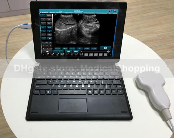 USB ultrasound probe+ultrasound software, ultrasound scanner connect any computer or tablet base on windows system