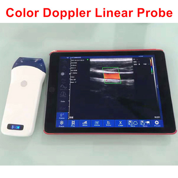 7.5-10Mhz128elements Wifi Linear Probe with color doppler,wireless ultrasound,ultrasonic linear probe,echo device,probe usg machine