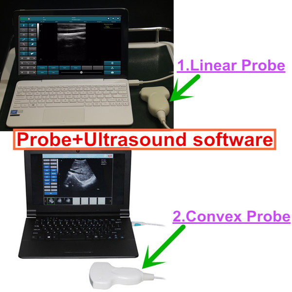 CE USB convex/linear probe+ultrasound software, ultrasound scanner, cheap ultrasound machine, B ultrasound, probe USG, Echo device