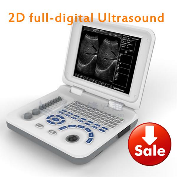 Human Sonography echo price/ultrasound machine/usg scanner/CE echo device/ultrasoinc notebook machine/stable ultrasound scanner