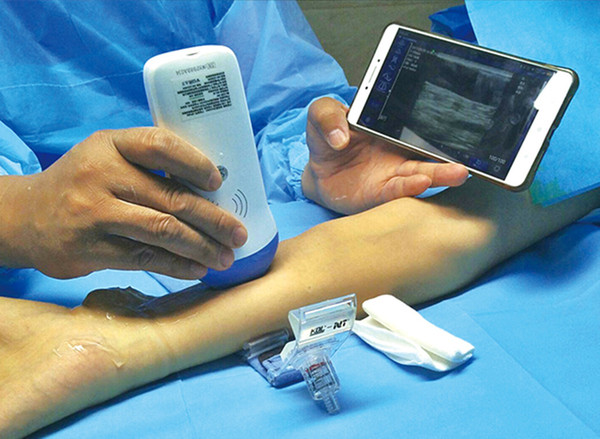 Probe mini ultrasound scanner/Small pocket USG/Wifi convex probe/wifi linear probe/USB probe echo/CE and ISO usg scanner, Sonography device