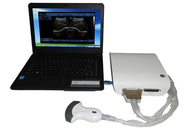 3D mini ultrasound box with ultrasound software pc, cheap price 3D ultrasound machine, ultrasonica diagnostic equipment free shipping