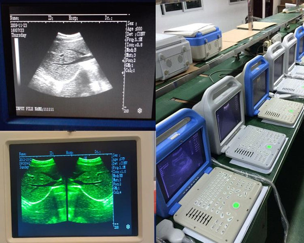 ISO USG ultrasonic machine/CE echo machine/stable sonography/High quality and factory price Laptop Ultrasound Scanner+12inch LCD screen