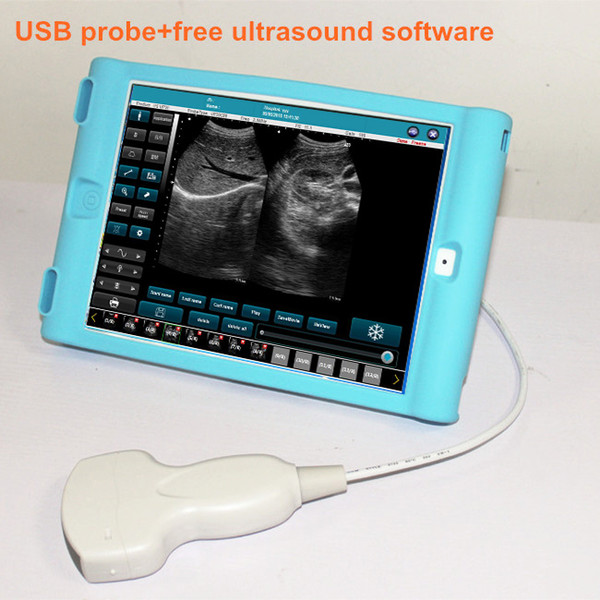 USB probe&ultrasound scanner&ultrasound machine&echo ultrasound&free shipping ultrasound probe+ultrasound software