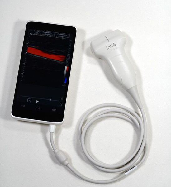 CE approved 5-10Mhz 80/128elements 6.0in full touch lcd screen phone PW color linear ultrasound machine , ultrasound scanner