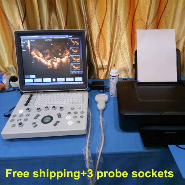 Laptop Ultrasound Scanner Diagnostic System, Portable Ultrasound +Convex Probe ,Notebook Style Medical
