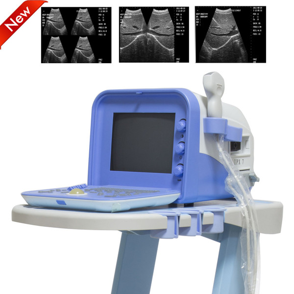 New LCD/LED screen Ultrasound machine, Diagnostic System Portable Ultrasound scanner portabele Style Medical Ultrasound with any one probe