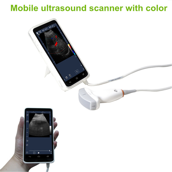 CE approved 2-5Mhz 80/128elements 6.0in full touch lcd screen phone color ultrasound machine with convex array probe, ultrasound scanner