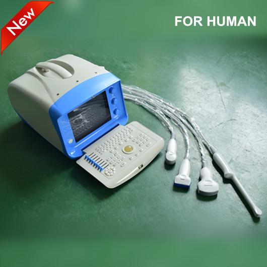 Free shipping portable ultrasound machine price, USG, ultrasound scanner, obstetric ultrasound, ecografo musculoskeletal, convex array probe