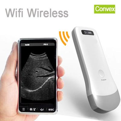 Wifi ipad ultrasound scanner,80/128 elements wireless ultrasound convex probe,ultrasound machine,wireless convex probe,usg scanner W-2C