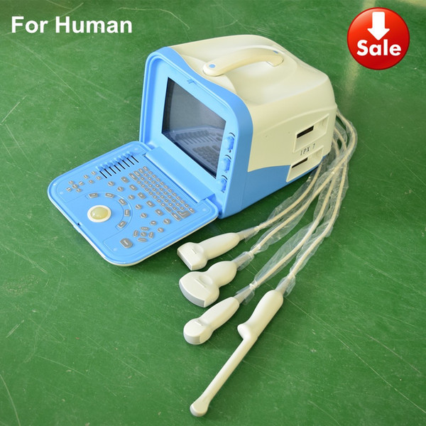 Ultrasound machine, ultrasound scanner with convex array probe,echo machine,echograph laptop, USG machine,scanner medical machine
