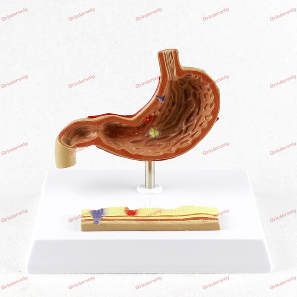 Human traumatic pistol skeleton trauma medical instruments Stomach with Ulcers anatomy Anatomical Display Science Teaching model