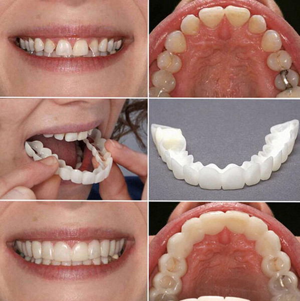 Give You Perfect Smile Dental Teeth Whitening Oral Correction Of Teeth For Bad Tooth Veneers Oral Care Products Snap On Smile