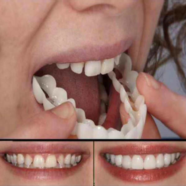 False Tooth Stickers Simulation Teeth Whitening Dentures Paste Braces Upper Tooth Cover Tool Perfect Smile Comfort Teeth Veneers