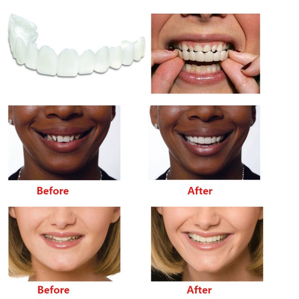 Tooth Orthodontic Braces Orthodontic Dental Appliance Trainer Alignment Braces for Teeth Straight Alignment Free Shipping