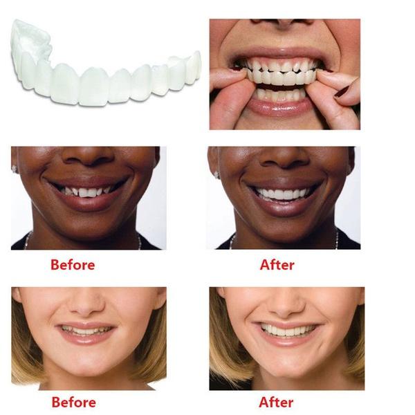 Instant Comfort Fit Cosmetic Whitening Teeth Denture Teeth Cover Top Cosmetic