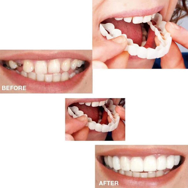 Beautiful Smile Veneers Teeth Braces Comfort Fit Cosmetic Wear resistance Teeth Denture Teeth Top Cosmetic Veneer Simulation