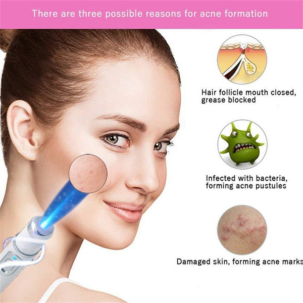 Acne Laser Pen Portable Wrinkle Removal Machine Durable Soft Scar Remover Blue Light Pen Massage spider vein Eraser KD-7910