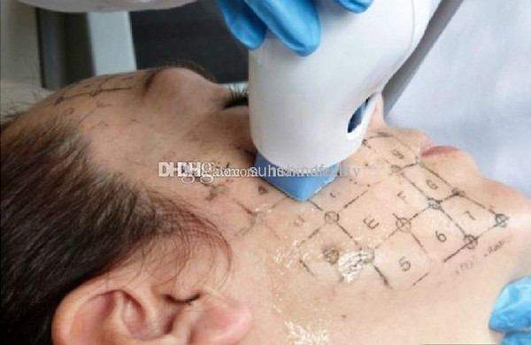 Thermage Beauty Machine Grid, Grating Used For Fractional RF Micor Needle Heads Thermage Drawing Paper For Eyes and Face